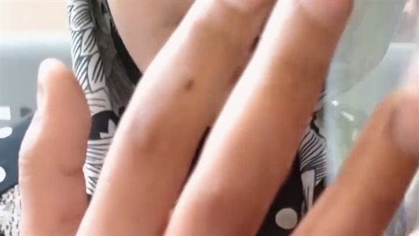 الطفلة ضحية تعذيب