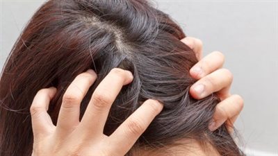 فروة الرأس المحروقة من الشمس.. خطر غير مرئي يهدد الصحة الجلدية 