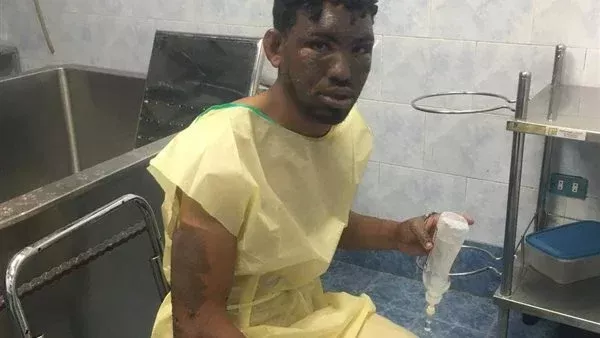 أحمد مصطفى أحد مصابي