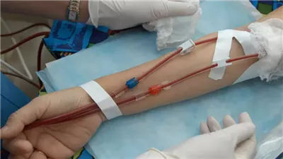 الصحة: تنفيذ أكثر من مليون و600 ألف جلسة غسيل كلوي مميكنة حتى الآن