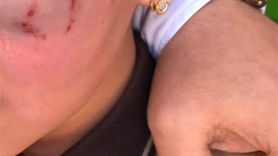 استبعاد معلم بعد اعتدائه على تلميذة داخل مدرسة في الدقهلية..وأول تعليق من والد الطفلة: 