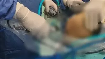 محامي حفيدة رئيس الوزراء الأسبق خلال المرافعة: المتهم كاتب إنه خبرة 10 سنوات في التجميل وهو أصلا صيدلي