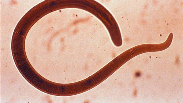 رؤية الديدان في المنام