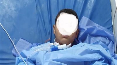 مستشفى سوهاج الجامعي ينقذ حياة طفل بعد اختراق سيخ معدني للرقبة والفك