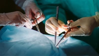 بسبب عمليات زراعة الأعضاء.. عدوى طفيلية نادرة تصيب الرجال في أمريكا