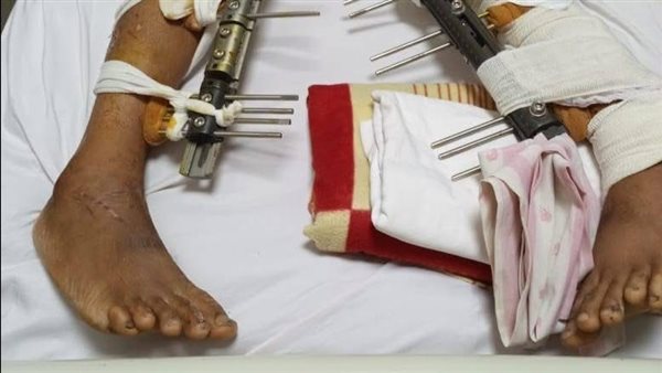 حالة الطالب في المستشفى