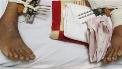 استجابة لما نشره القاهرة 24.. تعليم الأقصر يقرر عقد لجنة خاصة للطالب ياسين العدلي