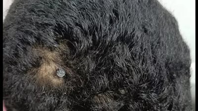 مستشفى الفيوم الجامعي يستخرج مسمارًا اخترق رأس صغير 