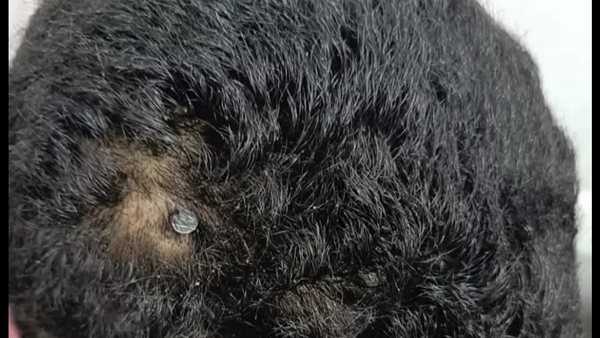 الطفل المصاب 