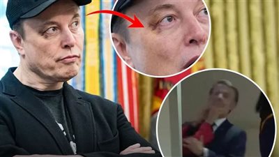 بعد ظهور كدمة في وجهه.. إيلون ماسك: مزحة من ابني ولم أكن بالقرب من فرنسا
