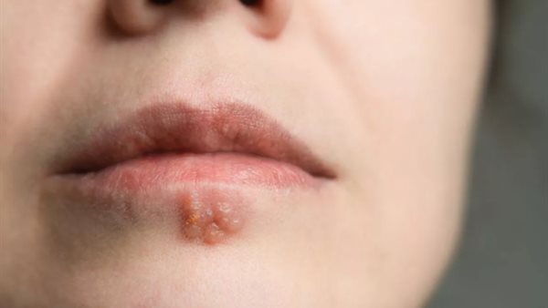 علامة على الشفاه