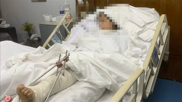 الفتاة المصابة 