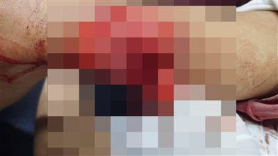 قالهم الحساب فين؟.. 3 أشخاص يمزقون جسد بائع سوبرماركت في شارع اللبيني بالهرم