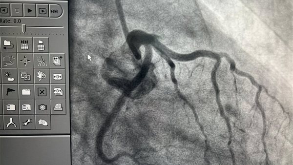 بعض من فحوصات حالات