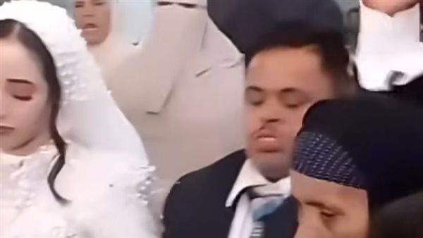 عريس متلازمة داون