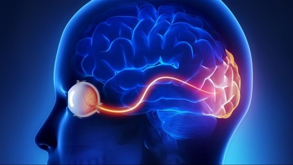 اعتلال بصري عصبي