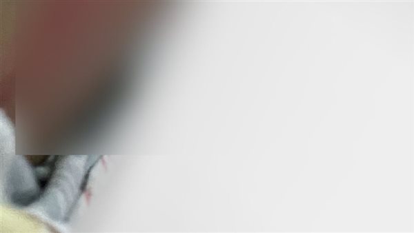 جانب من الاعتداء