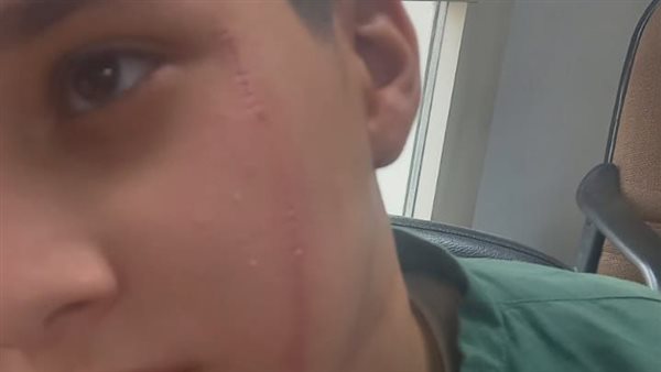 المجني عليه