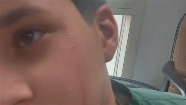 المجني عليه