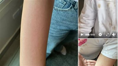 سيدة تشكو من اعتداء طالبات عليها داخل مقهى شهير بالتجمع الخامس: تم تمزيق حجابي وضربي