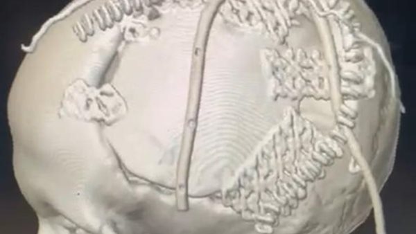 جانب من الجراحة 