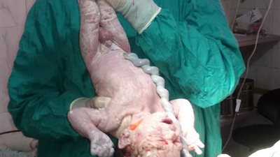 ربنا أنقذ نجلي.. طبيب بكفر الشيخ يعلن تخليه عن تقاضي أي مبالغ مالية نظير عمليات الولادة لمدة عام