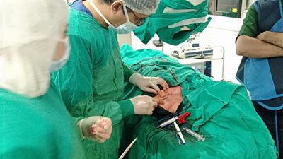 معهد جنوب مصر للأورام ينجح في إنقاذ مريض سرطان كلى باستخدام منظار البطن الجراحي