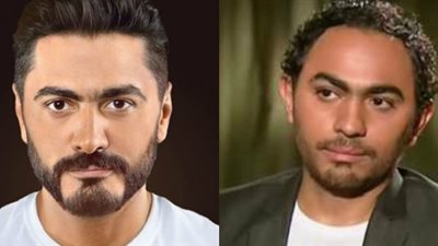 سر تحول وجه تامر حسني ليبدو أكثر تناسقًا في “الشعر والأذن والفك” (صور وفيديو)