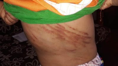 “الطفولة والأمومة” يكشف تفاصيل جديدة عن واقعة تعذيب طفلين بالقليوبية