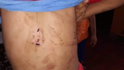 زواج عرفي وربط بالجنزير.. تفاصيل جديدة بشأن تعذيب طفلَيْ قليوب على يد زوج والدتهما (صورة)