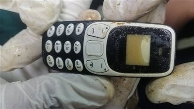 ابتلعه منذ عامين.. مستشفى الأزهر الجامعي بأسيوط يستخرج هاتف محمول من معدة مريض |صور