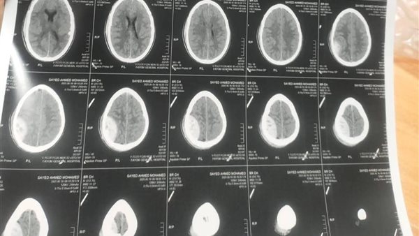 حاله المريض