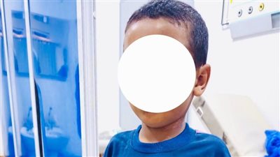 مستشفى جامعة سوهاج ينقذ حياة طفل تعرض لطعنة نافذة بالقلب