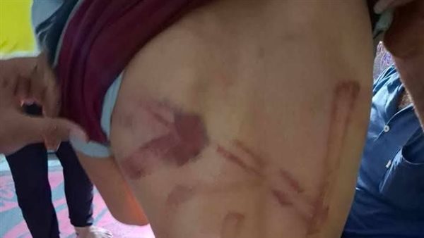 آثار الاعتداء على