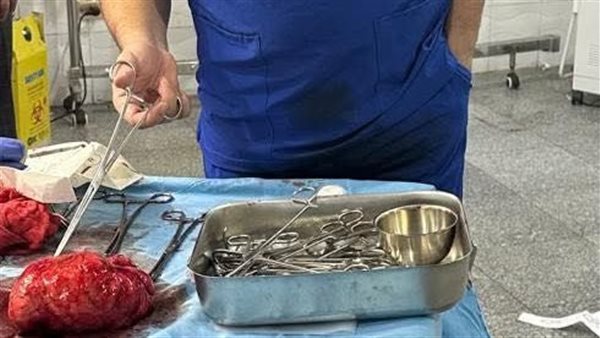 الورم بعد استئصاله