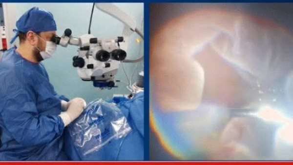  نجاح فريق طبي مصري