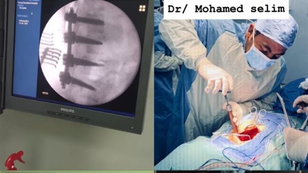 جانب من الجراحات