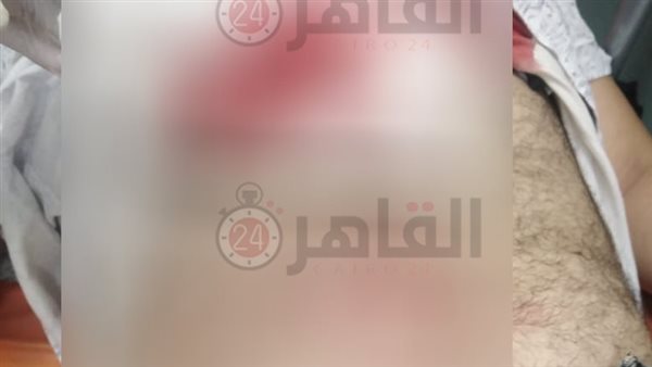 طعن فرد أمن 