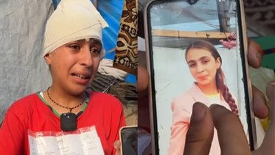 كنت جميلة.. الطفلة هلا دهليز تتصدر التريند بعد فقدان شعرها بسبب قصف الاحتلال