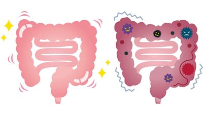 أفضل 5 طرق طبيعية لتنظيف القولون وتطهير الجهاز الهضمي في المنزل