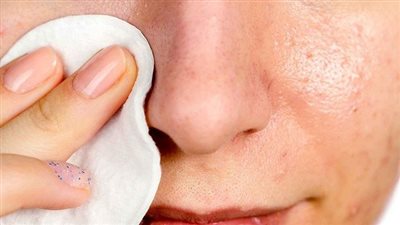 أفضل الطرق للتخلص من الرؤوس السوداء في المنزل باستخدام مكونات طبيعية