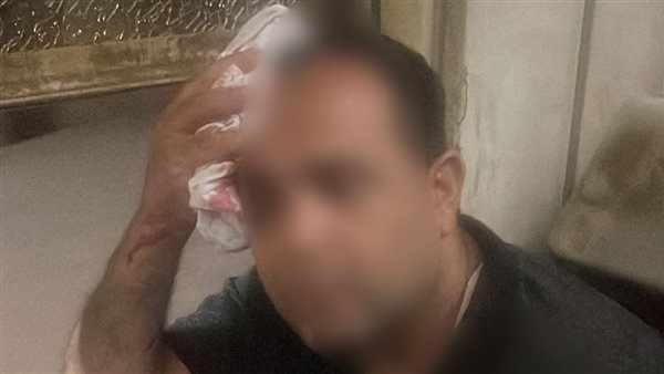 راكب القطار المصاب