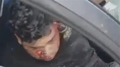 إصابة 3 أشخاص في تصادم سيارتين ملاكي على أحد الطرق بالتجمع |صور