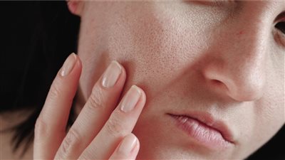 إزاي تعرف نوع بشرتك وطرق العناية اليومية بها بسهولة