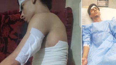 في غيبوبة.. أسرة طالب بالثانوية العامة تكشف تفاصيل الاعتداء عليه بسبب رفضه الغش بشبرا الخيمة