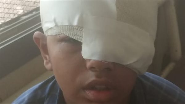 الصغير ضحية التنمر