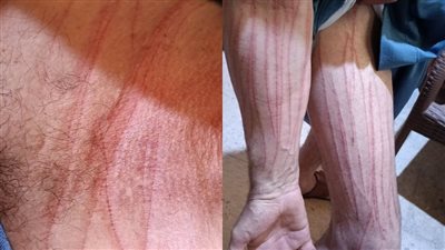 بسبب الميراث.. قصة متداولة لـ فتاة تتعرض للسحر الأسود على يد حماتها في الشرقية