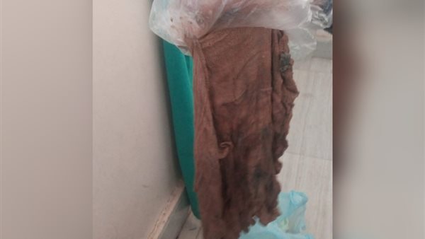 الفوطة بعد استخراجها