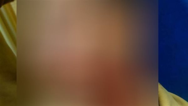 الشاب المصاب 