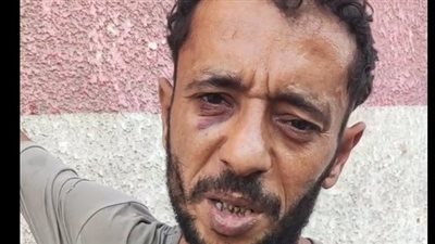 بعد خروجه من المستشفى.. أحد مصابي حادث انهيار عقار الساحل في شبرا: فقدت مصدر رزقي| فيديو